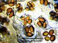 Tuber melanosporum-amf1903-asques et spores